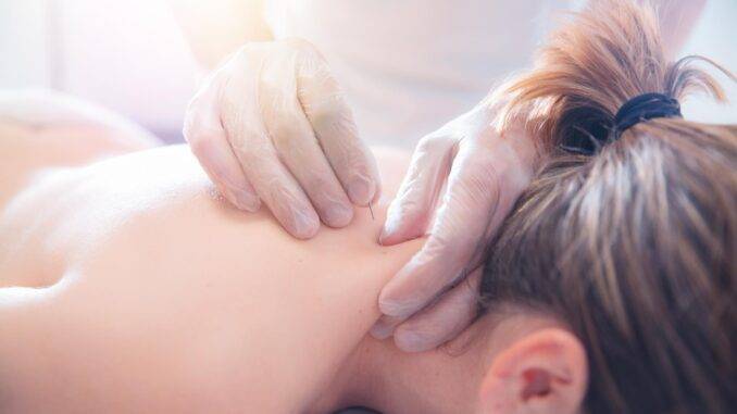 Physiotherapeutin bei der Akupunkturbehandlung einer jungen Frau auf dem Rücken